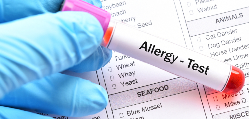 Allergy Analysis