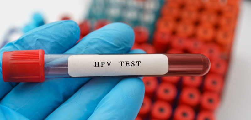 HPV Testing
